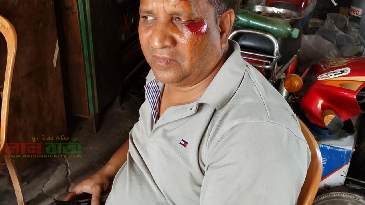 রাস্তায় ধানের খড় শুকানো: সড়ক দুর্ঘটনায় আহত তাড়াশ থানার এএসআই মকবুল হোসেন