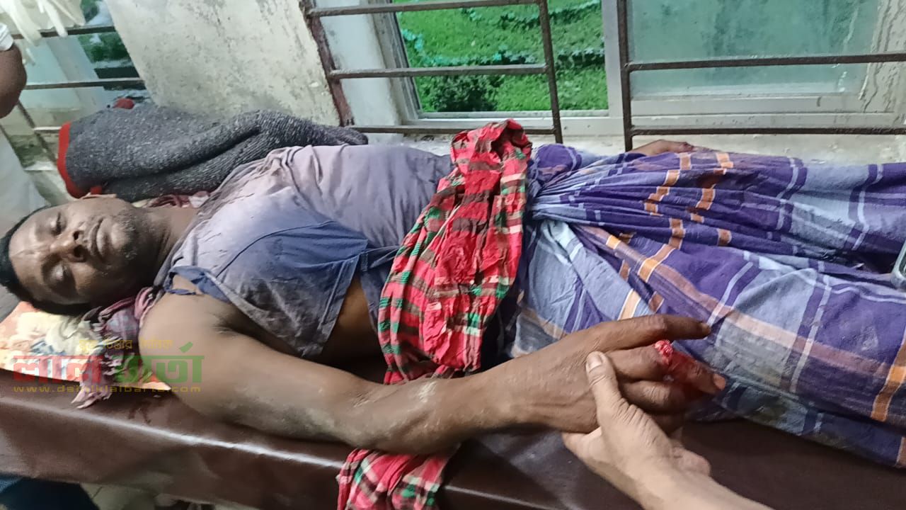 আঙুল কর্তনের মামলায় বাদীকে প্রাণনাশের হুমকি, আতঙ্কে পরিবার