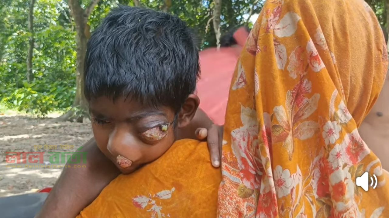 নিষ্পাপ রিমুর চোখে অন্ধকারের ছায়া: জীবন বাঁচাতে প্রয়োজন মানবিক সহযোগিতা