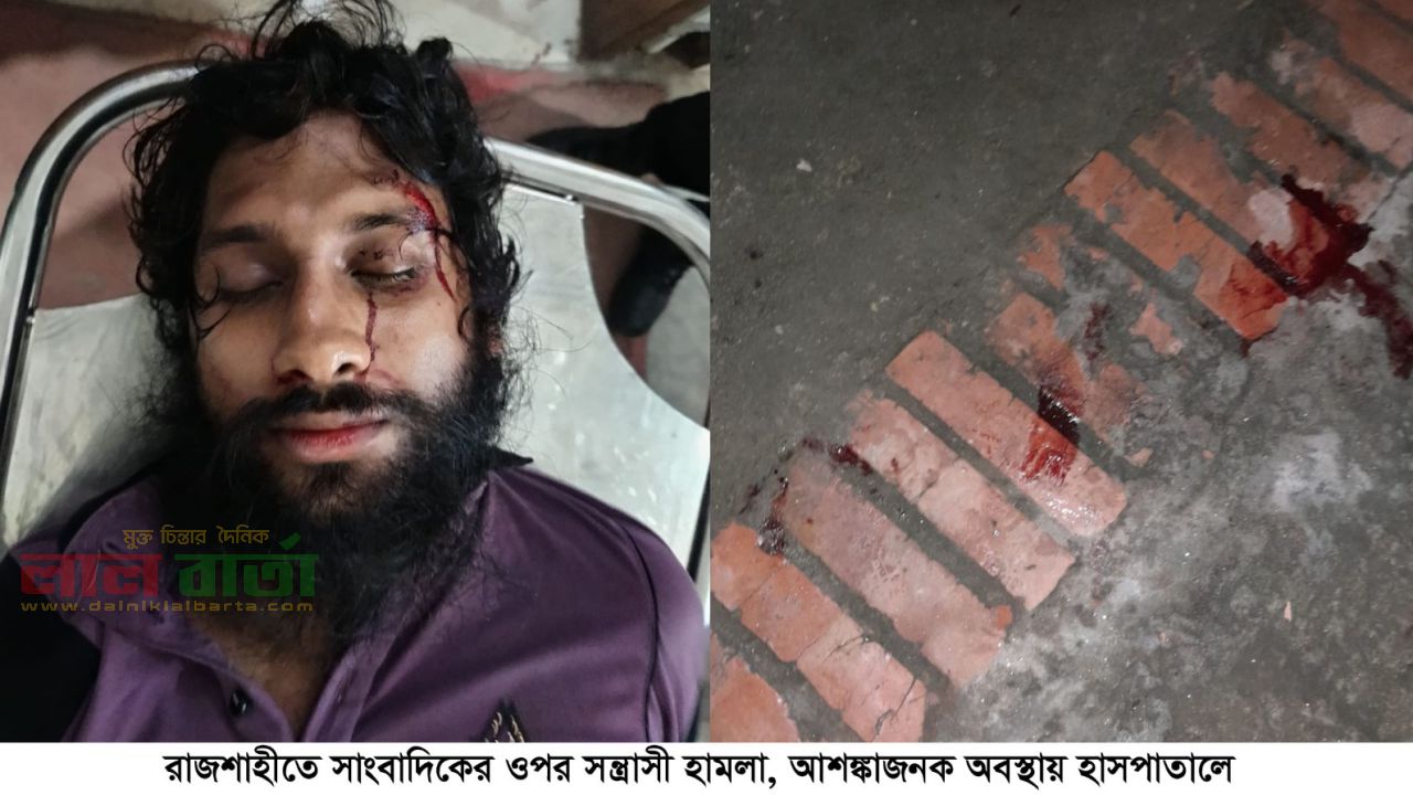 রাজশাহীতে সাংবাদিকের ওপর সন্ত্রাসী হামলা, আশঙ্কাজনক অবস্থায় হাসপাতালে