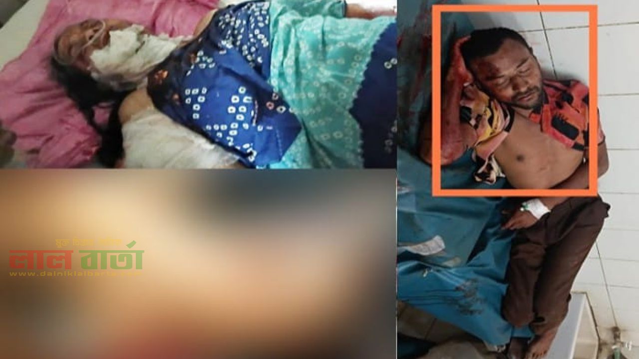 রাজশাহীতে মা ও ভাই কুপিয়ে জখম, মাদকাসক্ত গ্রেপ্তার