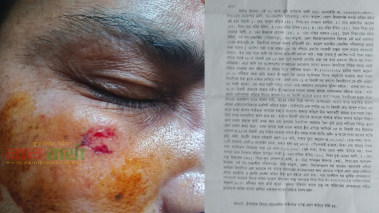 তাড়াশে সরকারি রাস্তা দখল করে ঘর নির্মাণে বাধা দেওয়ায় প্রতিপক্ষকে পিটিয়ে আহত
