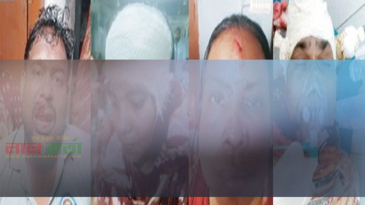 রাজশাহীতে জমি সংক্রান্ত বিরোধের জেরে প্রতিপক্ষের হামলায় ৫ জন আহত, পিতা-পুত্র গ্রেফতার